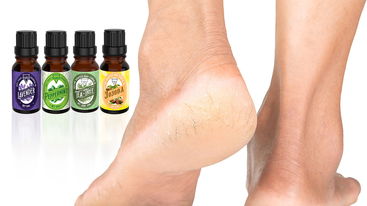 How to Make Essential Oil Roll-On Blend for Cracked Heels – BargzNY