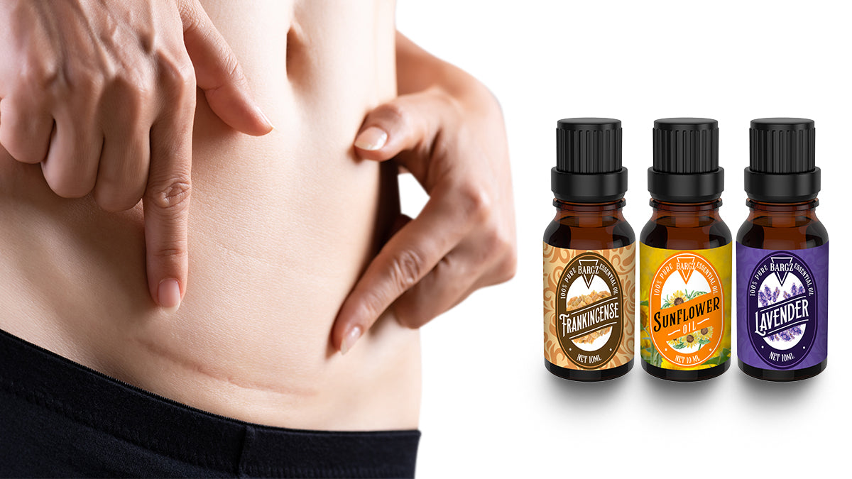 Learn About the Best Essential Oils For Healing Scars