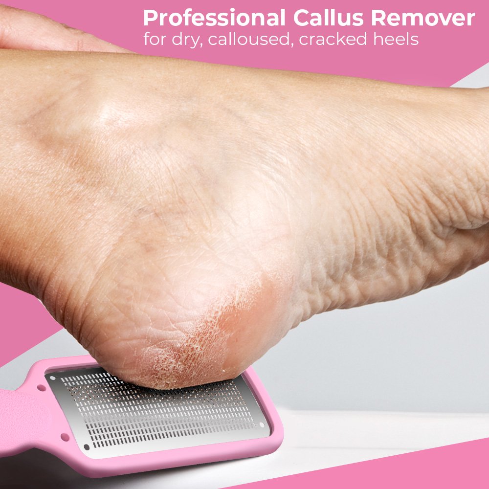 Nylea Foot File Callus Remover, Foot Rasp to Remove Hard Skin on Both Wet or Dry Feet.